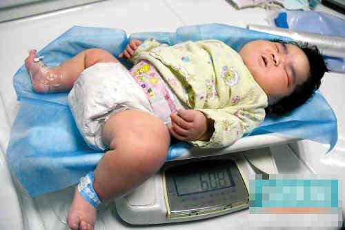 安徽41岁高龄产妇剖宫诞12斤半巨婴 _女性_腾讯网