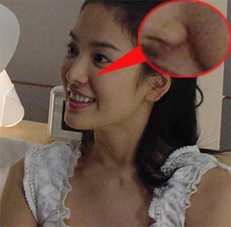 祛黑头产品排行榜10强_宋慧乔黑头涌现祛黑头谁强