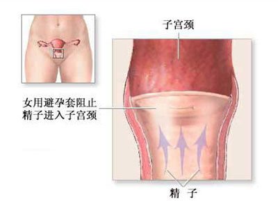 <em>组图</em>:全面目击<em>女人</em>避孕全过程_<em>女性</em>_腾讯网