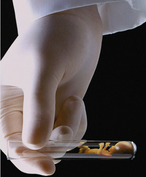 走进人工授精家庭：为何我们要一个自己的孩子