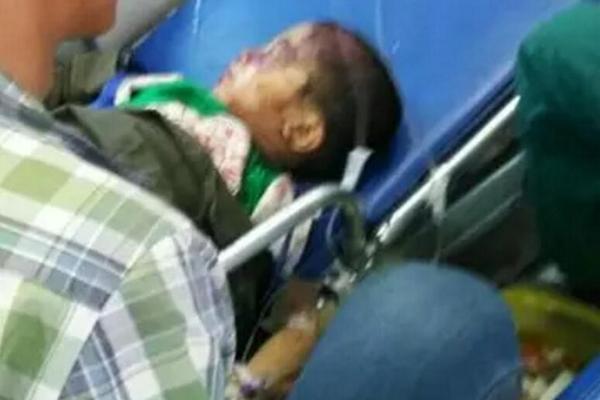 沈阳5岁男童被篮球架砸成重伤