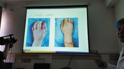 90��Ů��ʮָ����ֻʣ��ͷ���� ���3000����