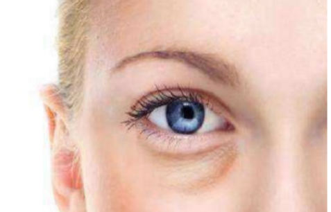 【良心推荐】快速去除下眼袋的方法有哪些