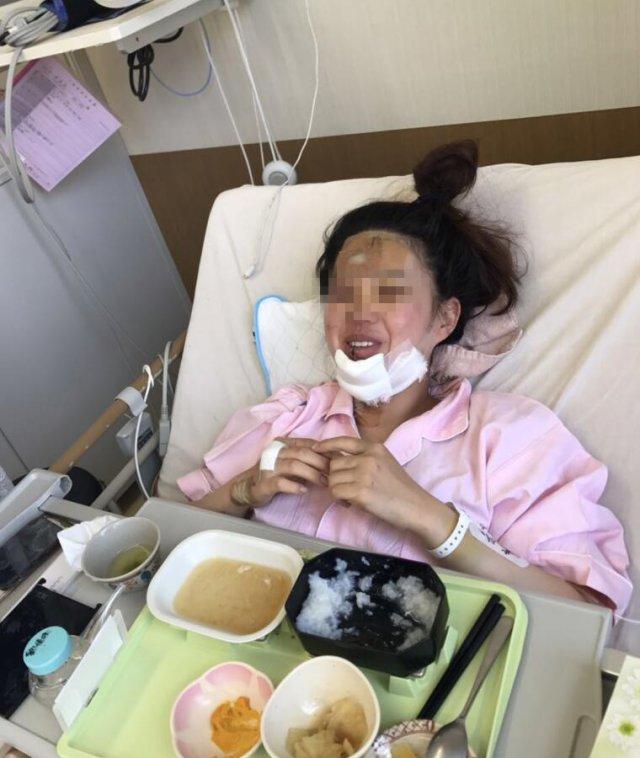 大连女孩在日本遭遇车祸 多部门为亲属办妥护