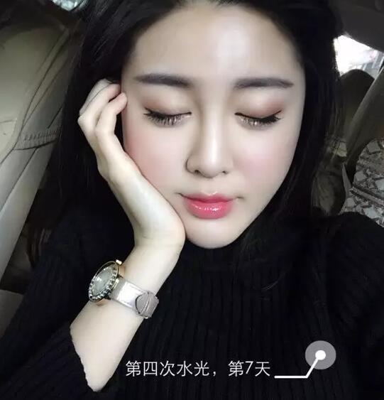 沈阳一妹子做完水光针后,竟把家里的上百张面膜全扔了?