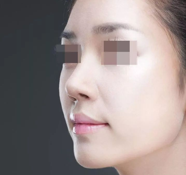 为什么你的高鼻子还不如人家的塌鼻子好看?