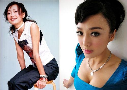 巩新亮变僵尸 整容过度的明星你知道吗_大辽网_腾讯网