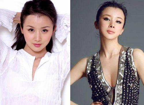 巩新亮变僵尸 整容过度的明星你知道吗