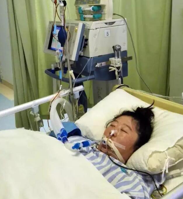 大连怀孕教师生命垂危 医生:成人出水痘不可小觑