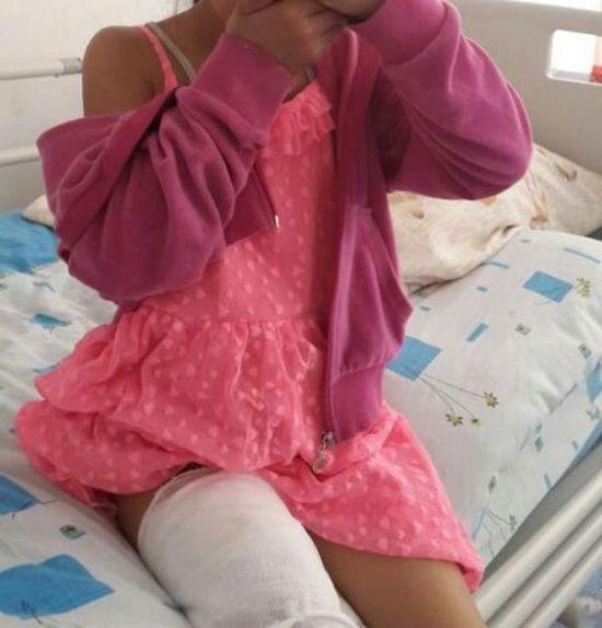 7岁小女孩腿部烧伤 三星再酿爆炸悲剧