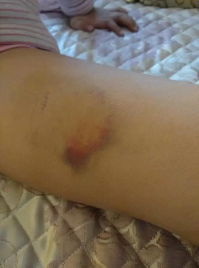 8��Ů���̳������������� ���䵹�º�����