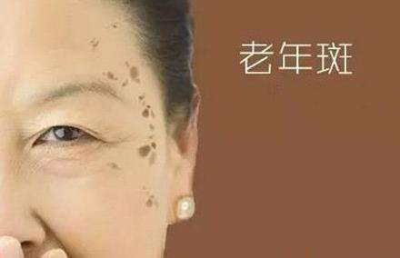 沈阳高温来临 这些防晒措施你真做对了吗?