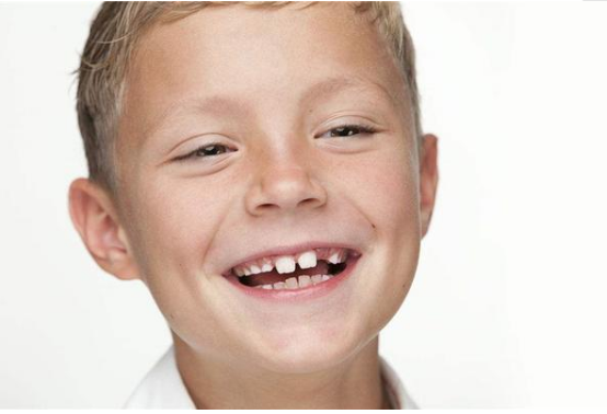 水牙线的危害你要知,如何正确使用冲牙器