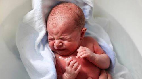 新生儿9种常见的皮肤问题