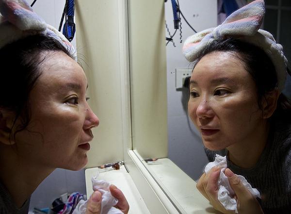 整容变毁容脸歪鼻子塌 美丽的代价有多大_大辽网_腾讯网