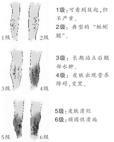 蚯蚓简谱_蚯蚓简笔画(2)