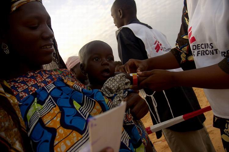 来自营养不良医疗前线的呼喊-非洲_图片故事