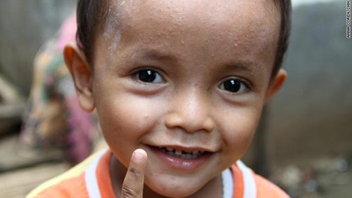 组图:印尼河流污染严重 儿童喝脏水脸长疱