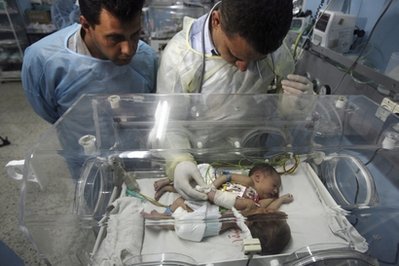 加沙连体女婴赴沙特手术 埃及破例开通边境