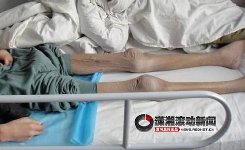 唐山一劳教所学员“骷髅死” 家属称其遭虐待