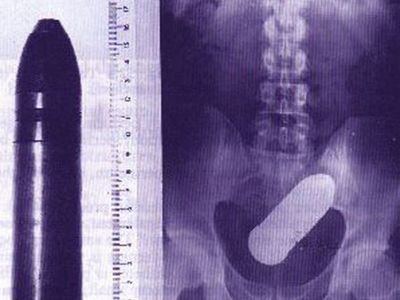 震惊!<em>女人</em>的<em>私处</em>竟然能放下这些东西_新闻_腾