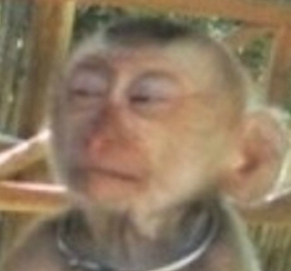 Ӥ�������ף���������ҽ�β����ز�ȡ�����ֶ� �ĺ���