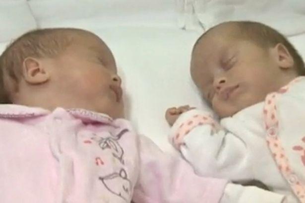 罗马尼亚一对双胞胎女婴 出生日期相隔2月(图