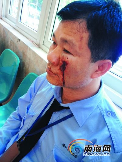 海口:两车刮蹭 16路<em>公交车司机被打</em>缝5针[图]_
