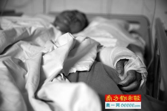 女子酒精洒身上欲吓退男友 对方点火致其重伤