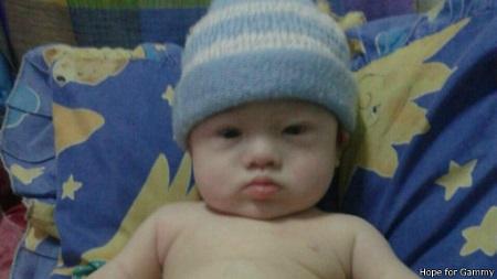 唐氏综合症男婴遭遗弃 泰国代孕母亲收留照顾
