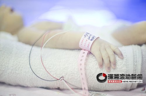婴儿吃奶时被妈妈乳房压住鼻孔窒息死亡(图)