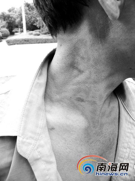 打工男子三亚招妓站街女设计仙人跳抢劫