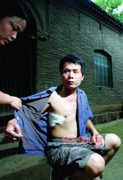 3年前一场悲壮的“开胸验肺”,让张海超维权成功并一举成名。CFP供图