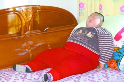 男童莫名发胖7岁已150斤 坐着睡觉两年(图)