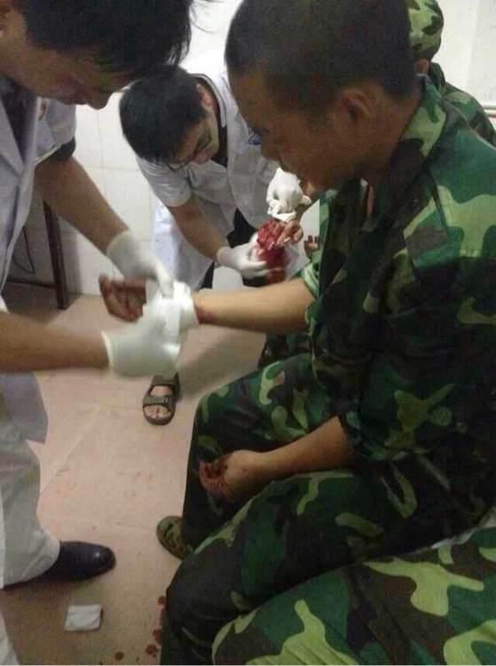 湖南一中学军训时教官与师生冲突 多名学生受伤