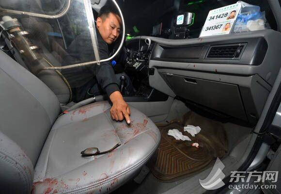 上海市民乘车遭老外无端暴打 眉骨开裂鼻骨骨折