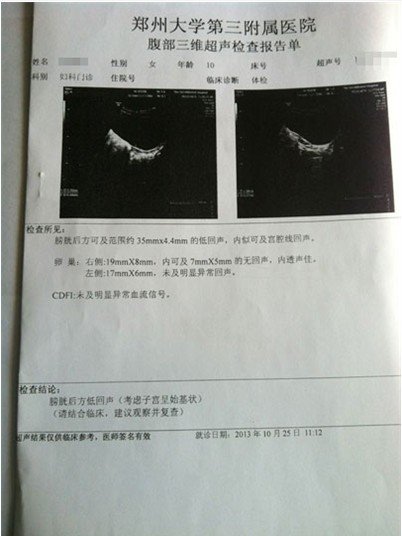 (田雪)近日,有媒体报道"郑州一名10岁女孩张某在医院做阑尾炎切除手术