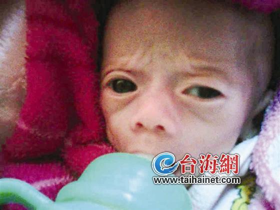 高中生诞下双胞胎女儿 患先天性巨结肠亟待救命 高中生诞下双胞胎女儿 患先天性巨结肠亟待救命