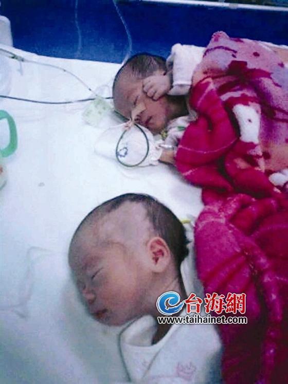 高中生诞下双胞胎女儿 患先天性巨结肠亟待救命 高中生诞下双胞胎女儿 患先天性巨结肠亟待救命