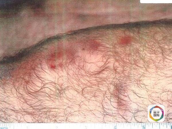 美军时隔十几年公开部分虐囚照片 被指避重就轻