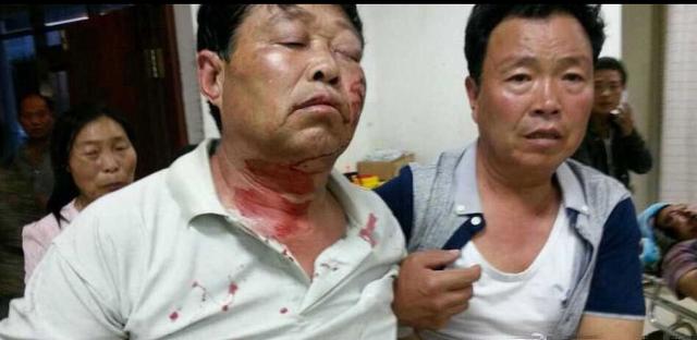 山西夏县征地引暴力冲突60人伤 10人伤势较重