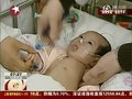 视频：安徽“独臂女婴”胸腔里暗“藏”手臂