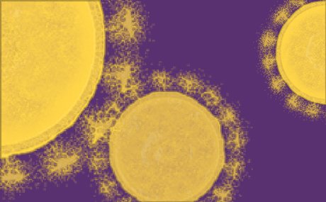 300X170