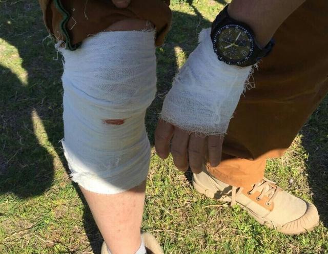 多国记者在叙遭炮击 中国记者被炮弹碎片击中