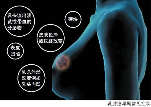 <em>女性</em>养生:<em>女人</em>三十后每年做一次乳腺b超很重要
