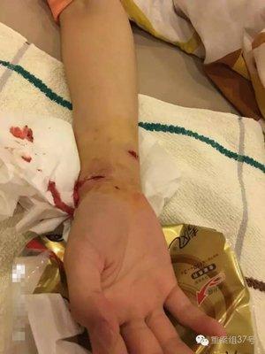 江苏小伙打死咬伤女友的狗被刑拘 还可能被批捕