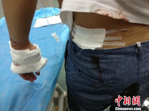 男子急于存钱与银行保安起争执 被捅5刀险丧