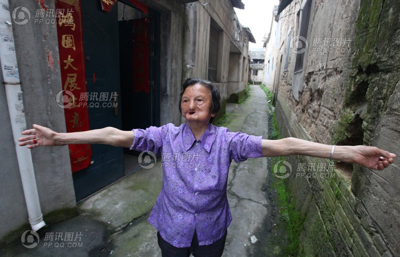 徐丙翠:<em>失去味觉</em>_幸存者_腾讯网