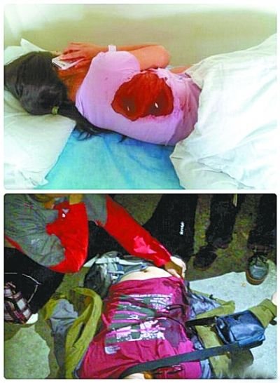 华山被捅游客质疑嫌犯顶包 称被群殴致伤