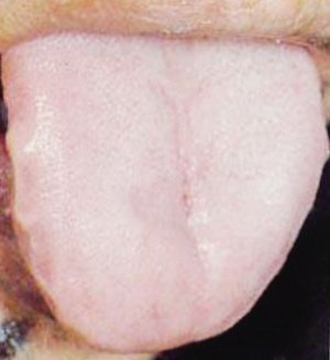 有病没病看舌头 专家:中医舌象确能反映身体状